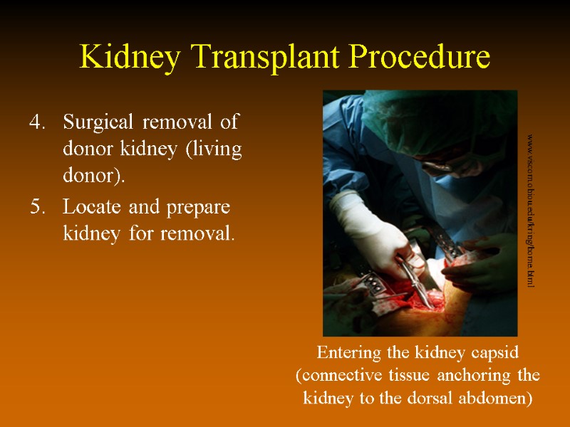 Kidney Transplant Procedure Surgical removal of donor kidney (living donor). Locate and prepare kidney